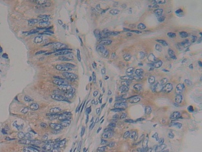 Polyclonal Antibody to 17-Beta-Hydroxysteroid Dehydrogenase Type 12 (HSD17b12)