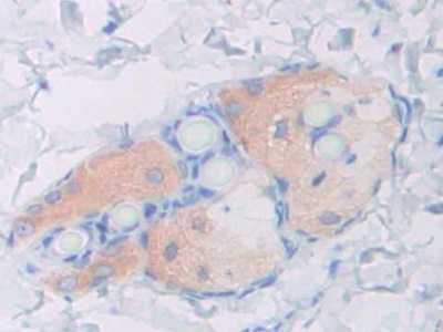 Polyclonal Antibody to 17-Beta-Hydroxysteroid Dehydrogenase Type 12 (HSD17b12)