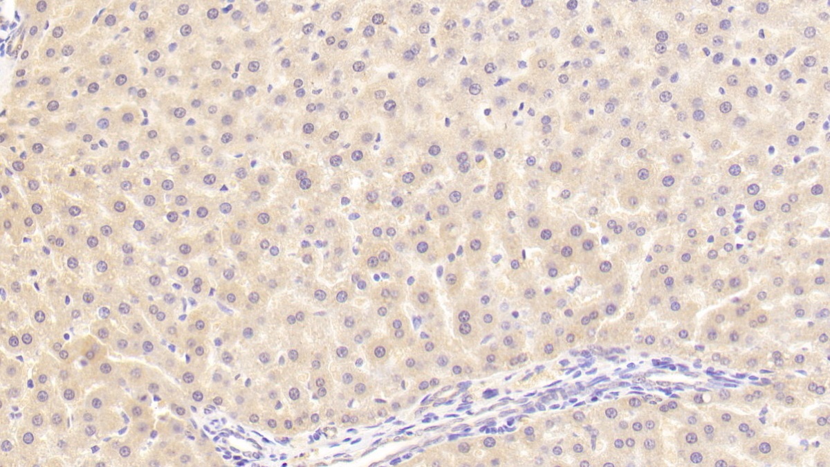 Polyclonal Antibody to 17-Beta-Hydroxysteroid Dehydrogenase Type 12 (HSD17b12)