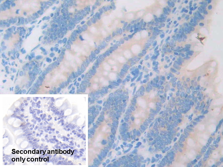 Polyclonal Antibody to 17-Beta-Hydroxysteroid Dehydrogenase Type 12 (HSD17b12)