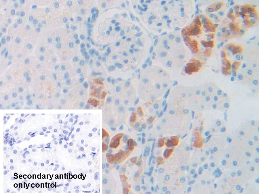 Polyclonal Antibody to 17-Beta-Hydroxysteroid Dehydrogenase Type 12 (HSD17b12)