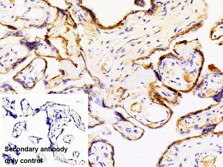 Polyclonal Antibody to 11-Beta-Hydroxysteroid Dehydrogenase Type 2 (HSD11b2)