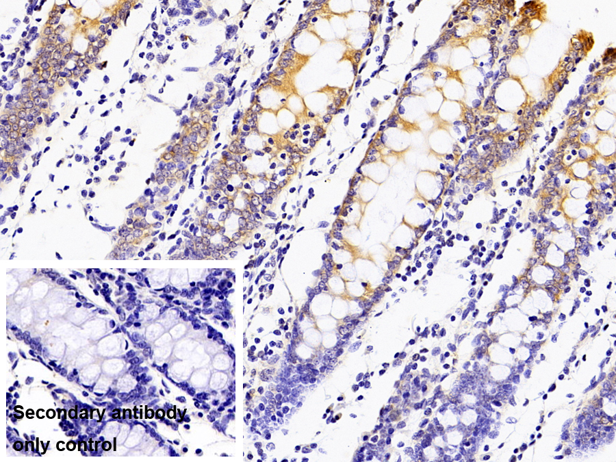 Polyclonal Antibody to 11-Beta-Hydroxysteroid Dehydrogenase Type 2 (HSD11b2)