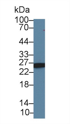 Polyclonal Antibody to Adenylate Kinase 3 (AK3)