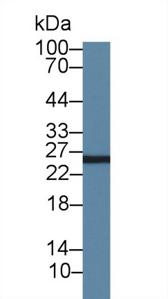 Polyclonal Antibody to Adenylate Kinase 3 (AK3)