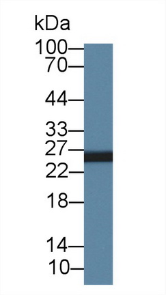 Polyclonal Antibody to Adenylate Kinase 3 (AK3)