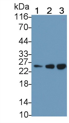 Polyclonal Antibody to Adenylate Kinase 3 (AK3)