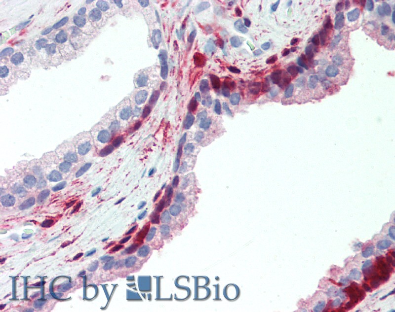 Polyclonal Antibody to Anthrax Toxin Receptor 2 (ANTXR2)