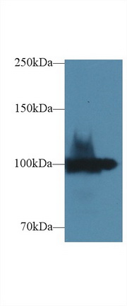 Polyclonal Antibody to Ectonucleotide Pyrophosphatase/Phosphodiesterase 1 (ENPP1)