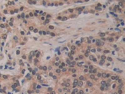 Polyclonal Antibody to Breast Carcinoma Amplified Sequence 3 (BCAS3)