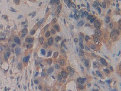 Polyclonal Antibody to Breast Carcinoma Amplified Sequence 3 (BCAS3)