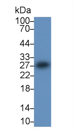 Polyclonal Antibody to Bcl2 Associated Athanogene 2 (BAG2)