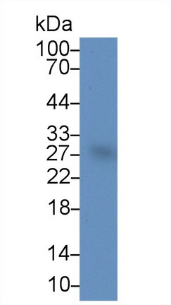 Polyclonal Antibody to Bcl2 Associated Athanogene 2 (BAG2)