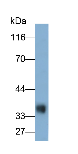 Polyclonal Antibody to Bestrophin 2 (BEST2)