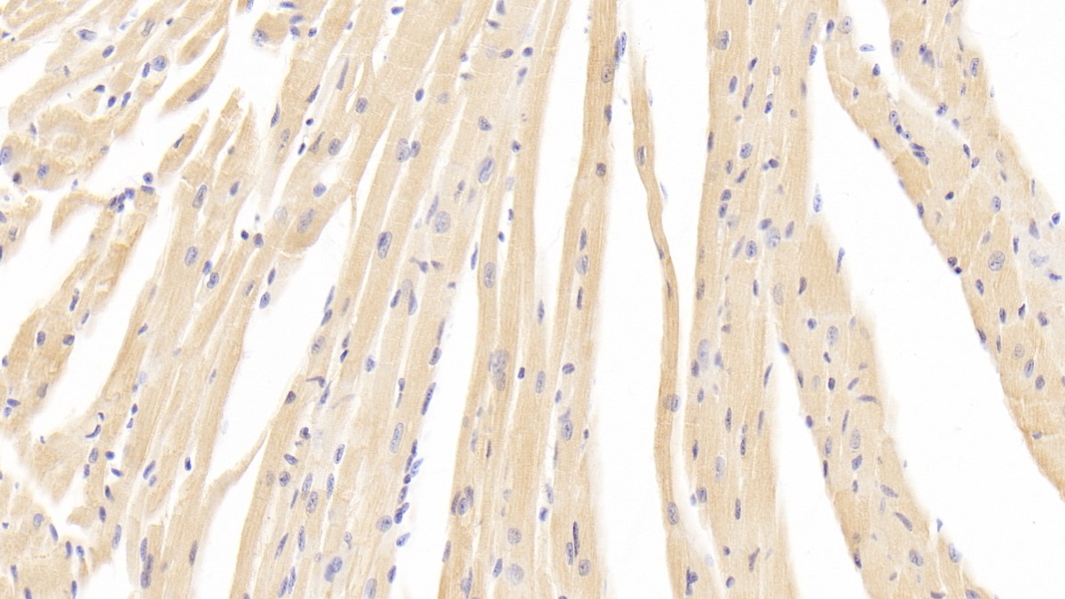 Polyclonal Antibody to Calcium Channel, Voltage Dependent, L-Type, Alpha 1C Subunit (CACNa1C)