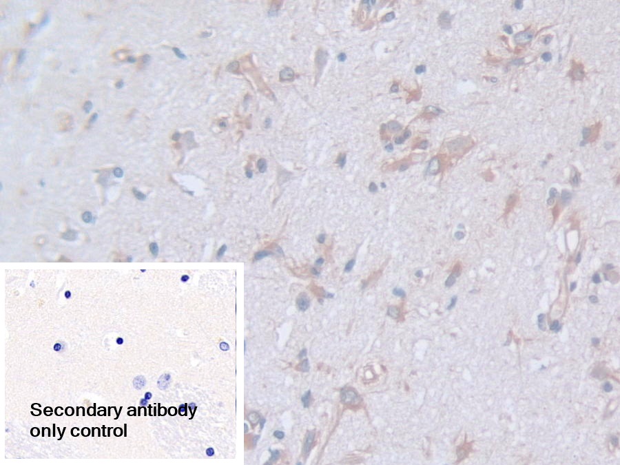 Polyclonal Antibody to Calpain, Small Subunit 1 (CAPNS1)