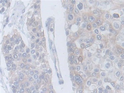 Polyclonal Antibody to Cytokine Receptor Like Factor 1 (CRLF1)