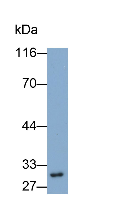 Polyclonal Antibody to Chloride Intracellular Channel Protein 4 (CLIC4)