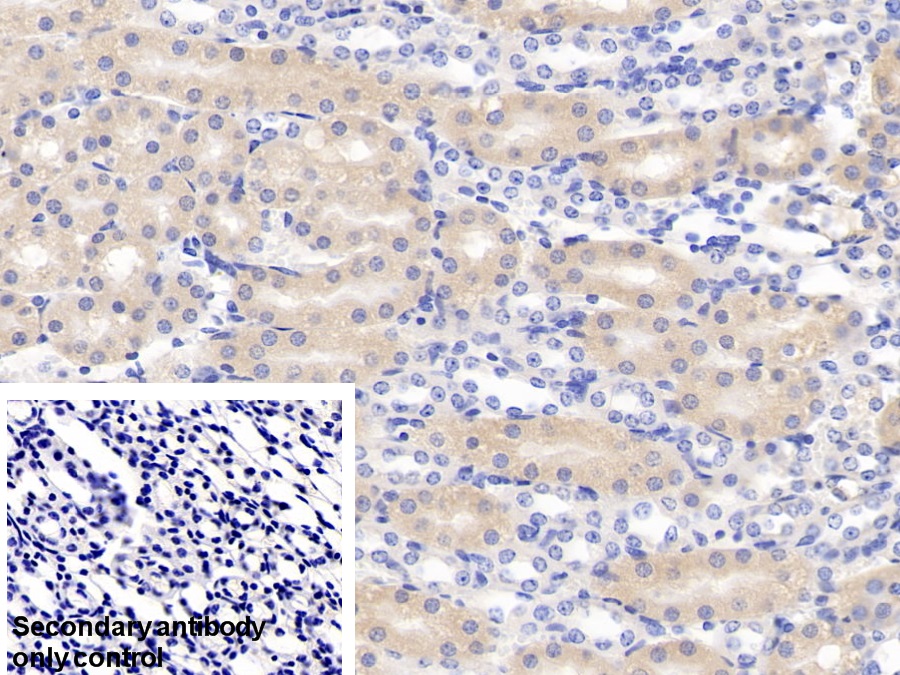 Polyclonal Antibody to Chloride Intracellular Channel Protein 4 (CLIC4)