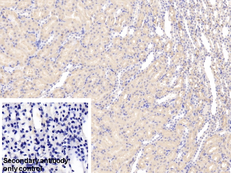 Polyclonal Antibody to Chloride Intracellular Channel Protein 4 (CLIC4)