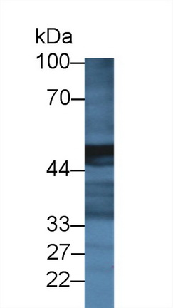 Polyclonal Antibody to Carboxypeptidase A2, Pancreatic (CPA2)