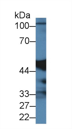 Polyclonal Antibody to Carboxypeptidase A2, Pancreatic (CPA2)