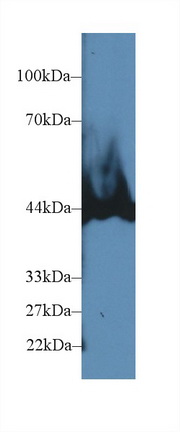 Polyclonal Antibody to Carboxypeptidase B1, Tissue (CPB1)