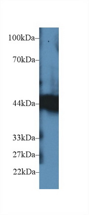 Polyclonal Antibody to Carboxypeptidase B1, Tissue (CPB1)