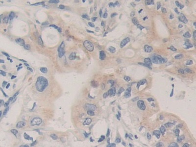 Polyclonal Antibody to Carboxypeptidase B1, Tissue (CPB1)