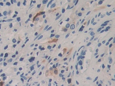 Polyclonal Antibody to Carboxypeptidase B1, Tissue (CPB1)