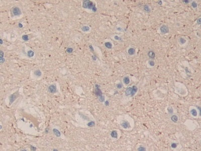 Polyclonal Antibody to Carboxypeptidase B1, Tissue (CPB1)