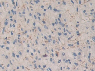 Polyclonal Antibody to Carboxypeptidase B1, Tissue (CPB1)