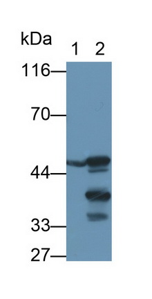 Polyclonal Antibody to Carboxypeptidase B1, Tissue (CPB1)