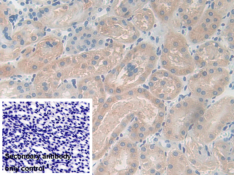 Polyclonal Antibody to Carboxypeptidase B1, Tissue (CPB1)