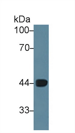 Polyclonal Antibody to Carboxypeptidase B1, Tissue (CPB1)