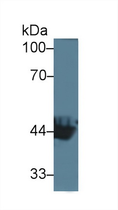 Polyclonal Antibody to Carboxypeptidase B1, Tissue (CPB1)