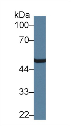 Polyclonal Antibody to Carboxypeptidase N1 (CPN1)