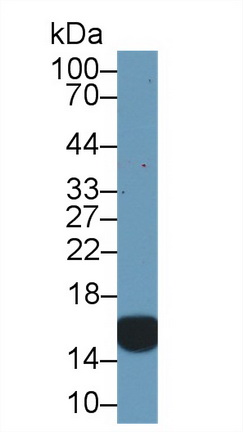 Polyclonal Antibody to Cellular Retinoic Acid Binding Protein 2 (CRABP2)