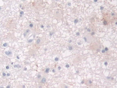 Polyclonal Antibody to Cellular Retinoic Acid Binding Protein 2 (CRABP2)