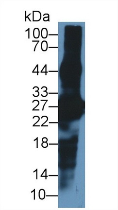 Polyclonal Antibody to Crystallin Beta A1 (CRYbA1)