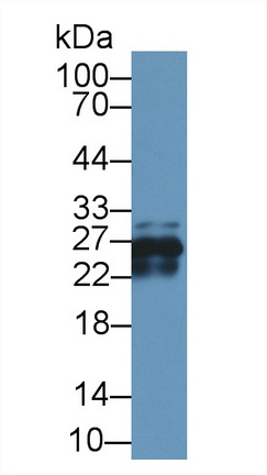 Polyclonal Antibody to Crystallin Beta A1 (CRYbA1)