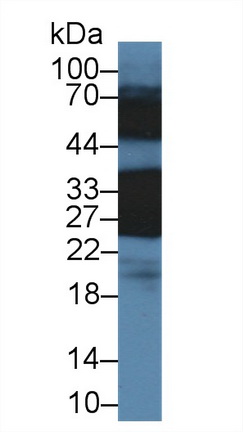 Polyclonal Antibody to Crystallin Beta B1 (CRYbB1)