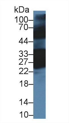 Polyclonal Antibody to Crystallin Beta B1 (CRYbB1)