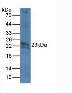 Polyclonal Antibody to Crystallin Beta B2 (CRYbB2)