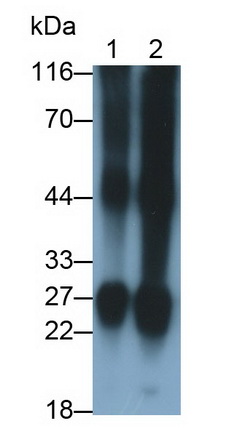 Polyclonal Antibody to Crystallin Beta B2 (CRYbB2)