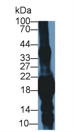 Polyclonal Antibody to Crystallin Gamma S (CRYgS)