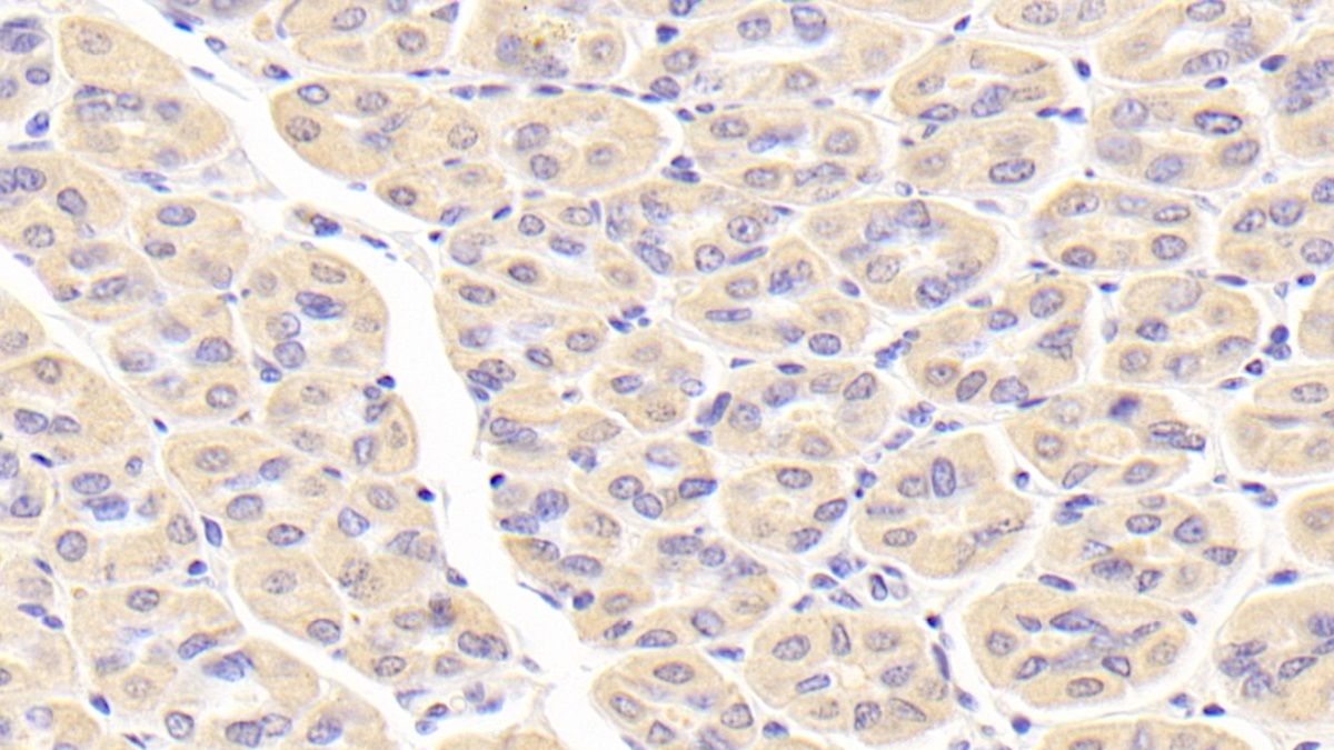 Polyclonal Antibody to Crystallin Gamma S (CRYgS)