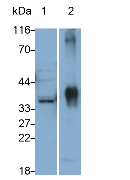 Polyclonal Antibody to Crystallin Lambda 1 (CRYl1)