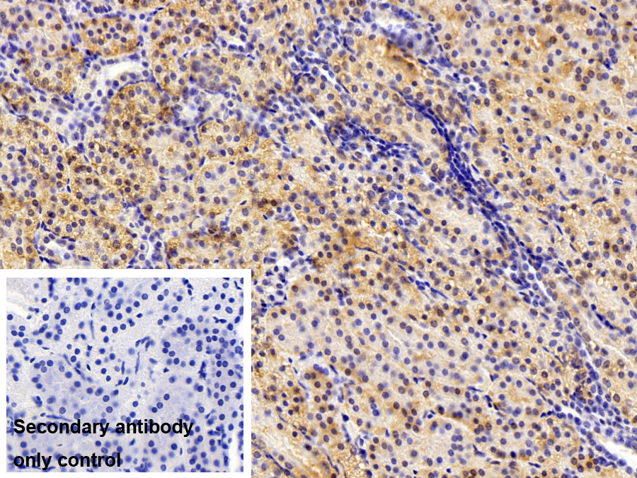 Polyclonal Antibody to Crystallin Lambda 1 (CRYl1)