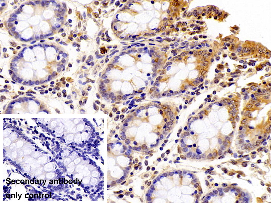 Polyclonal Antibody to Crystallin Lambda 1 (CRYl1)